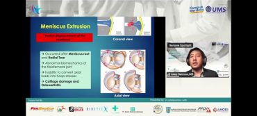 Prodi Fisioterapi UMS Kembali Adakan APC 2022